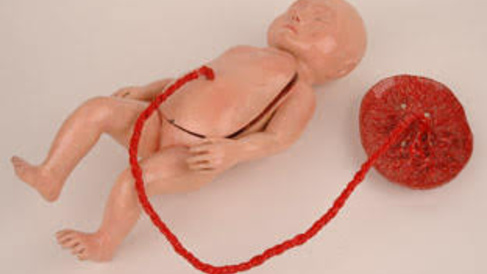 Model of a foetus with detachable front covering removable organs.